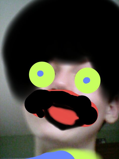 boy with afro and blue eyes with yellow whites